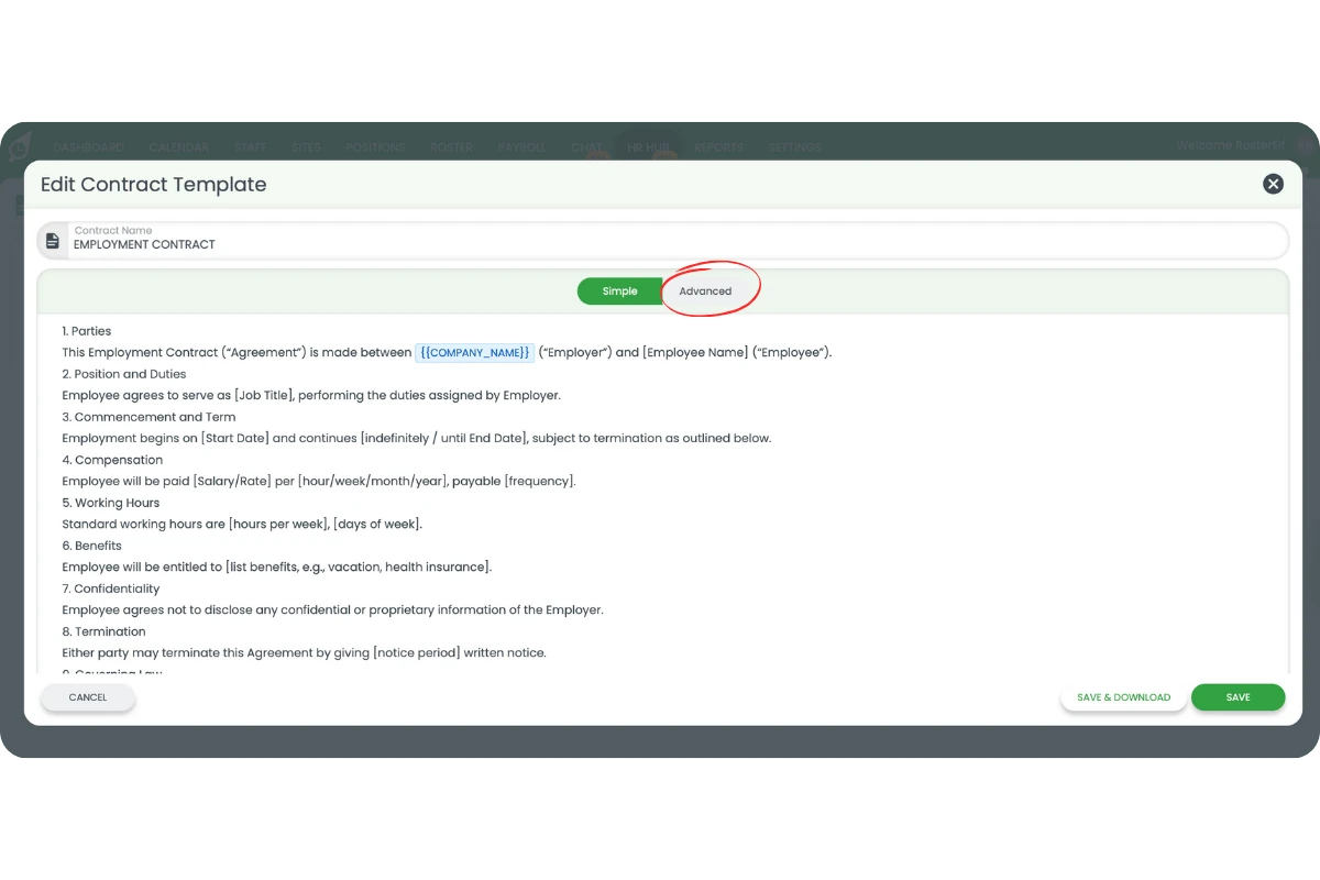 Edit Contract Template with Advanced mode selected in the editor toolbar