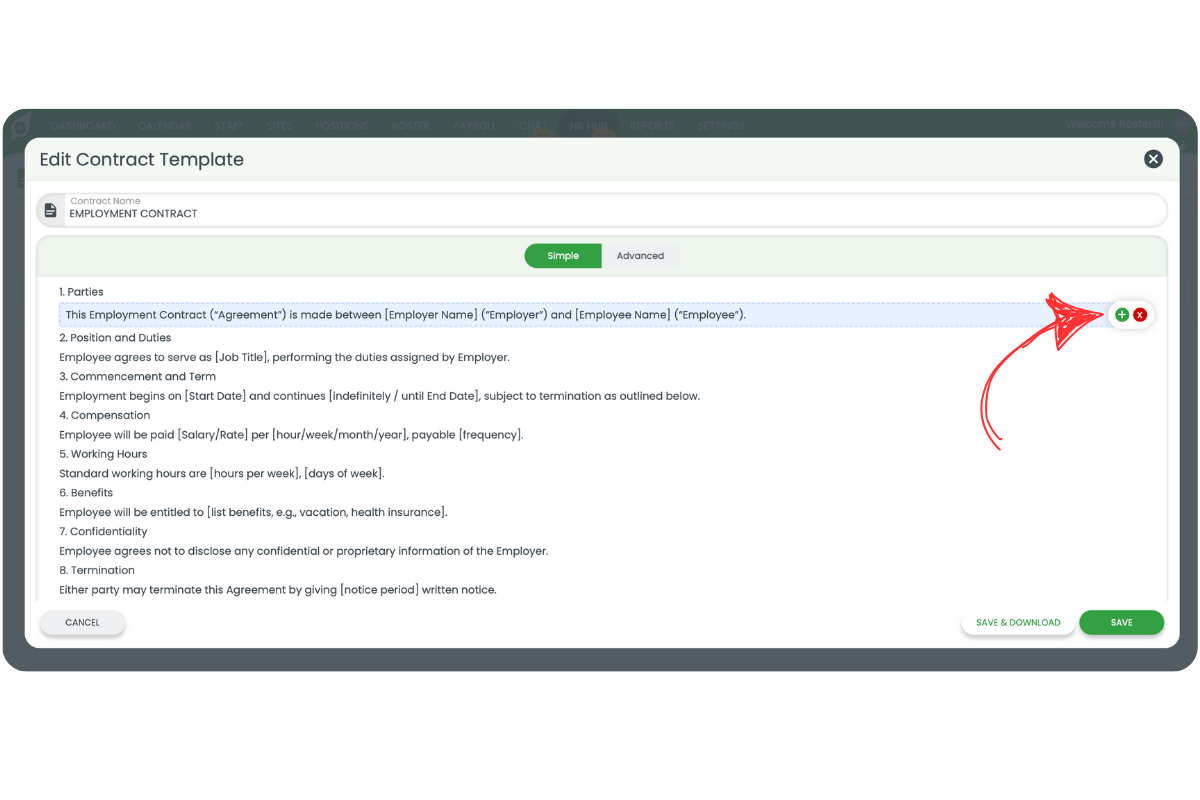 Edit Contract Template in Simple mode with plus and x icons visible on hover