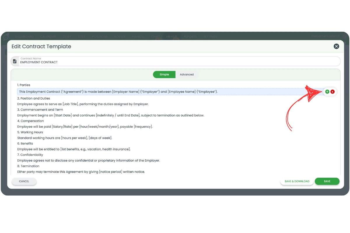 Edit Contract Template in Simple mode with plus and x icons visible on hover